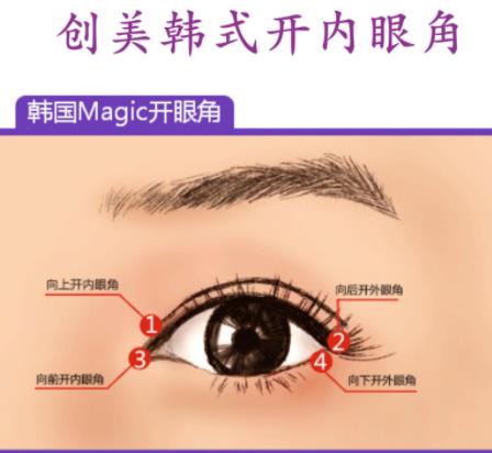 雙眼皮01.jpg