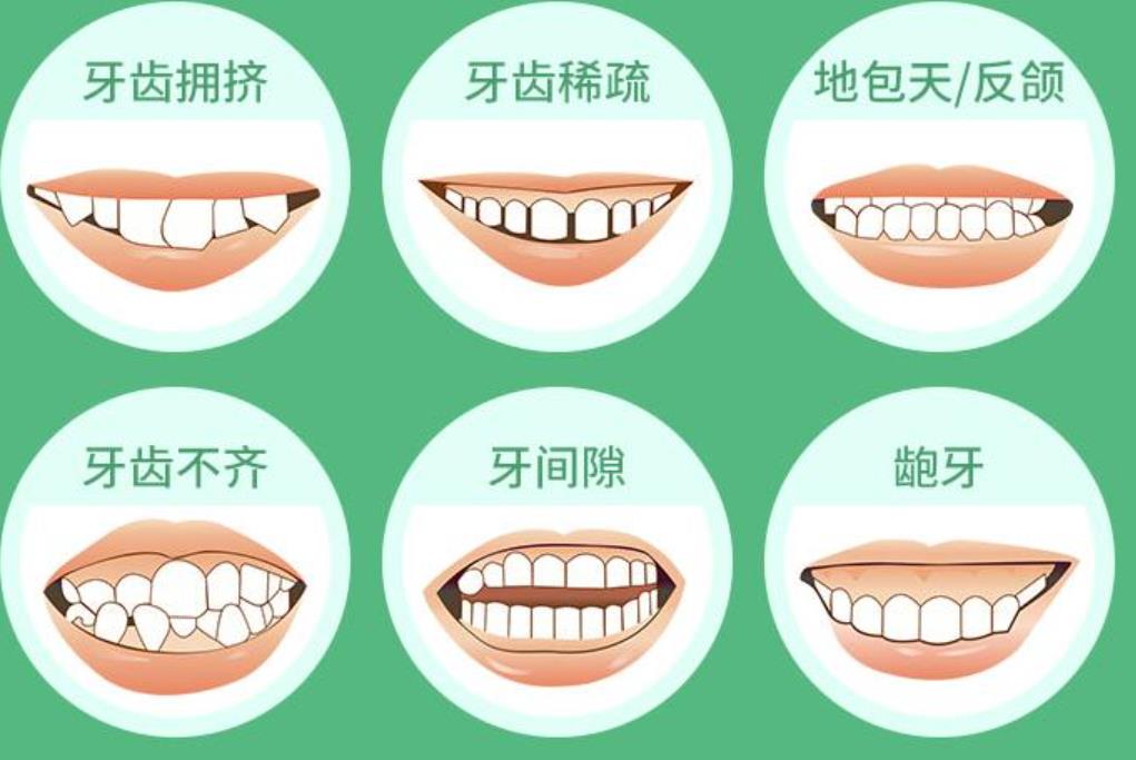 牙齒矯正動(dòng)漫02.jpg