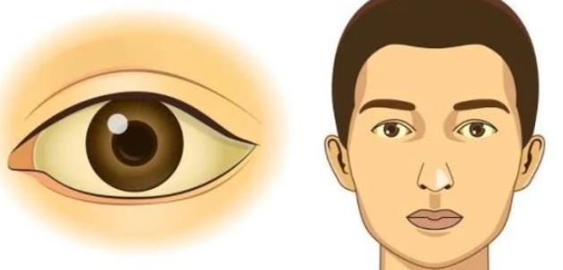雙眼皮修復(fù)動(dòng)漫hg02.jpg