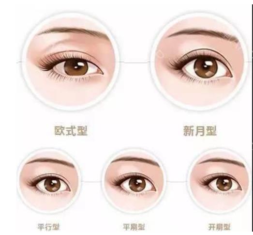 雙眼皮001.jpg