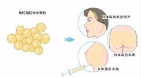自體填充動(dòng)漫2.jpg