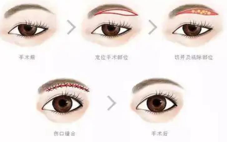 提眉動漫010.jpg