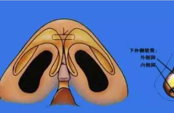 鼻頭縮小1.jpg