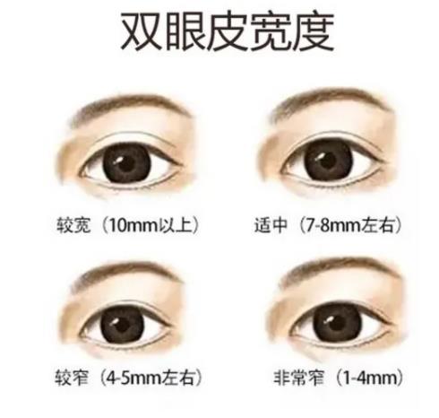 雙眼皮q23.jpg