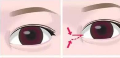 開眼角動漫4.jpg