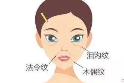 鼻唇溝動漫02.jpg