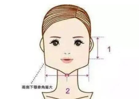 下頜角動漫06.jpg