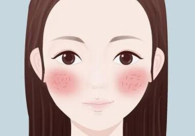 去紅血絲動(dòng)漫.jpg