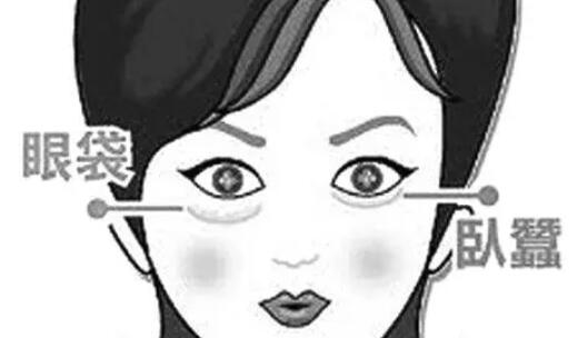 去眼袋動(dòng)漫35.jpg