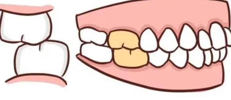 牙齒矯正dm04.jpg