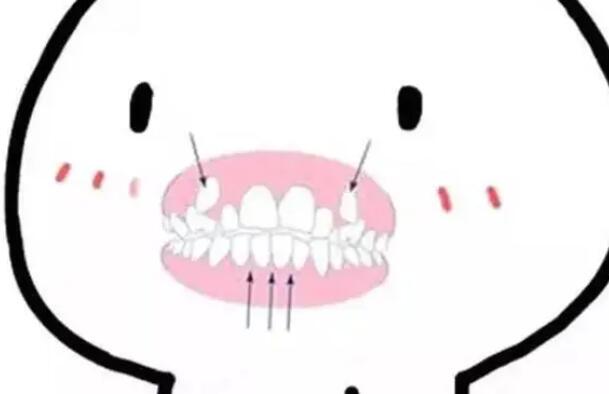 牙齒矯正動(dòng)漫32.jpg