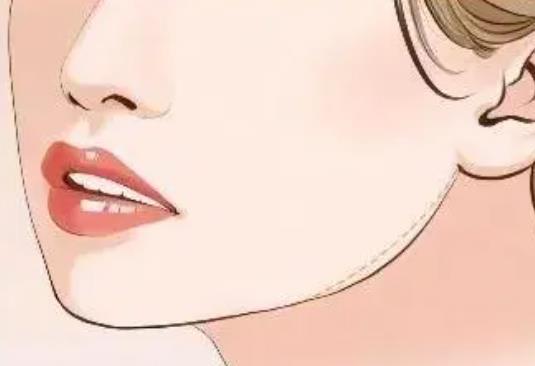 下頜角不對稱03.jpg