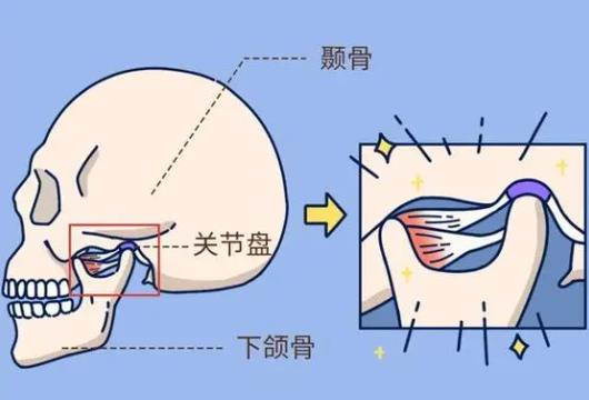 下頜角不對稱04.jpg