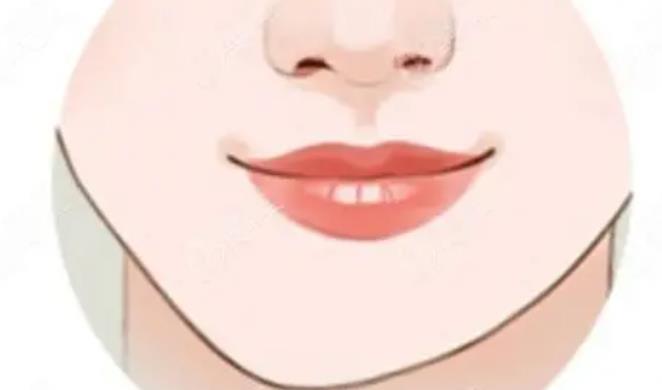 下頜角不對稱02.jpg