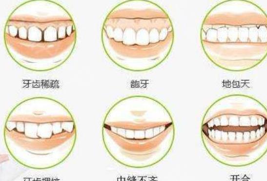 牙齒矯正hg09.jpg