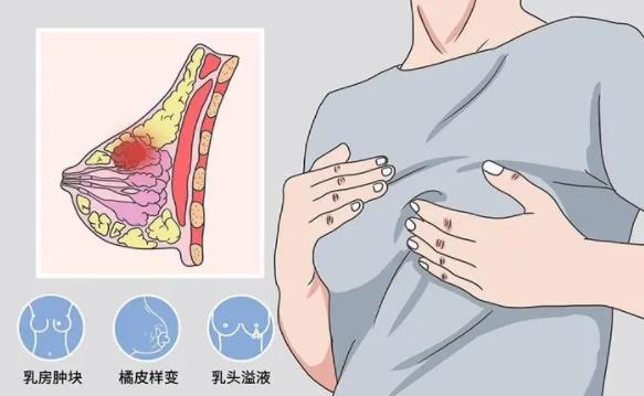 脂肪隆胸動漫02.jpg