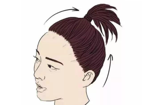 種植頭發(fā)怎樣種植？快來看詳細的介紹~