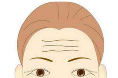 抬頭紋怎么祛除？熱門方法及優(yōu)勢(shì)集中一覽~