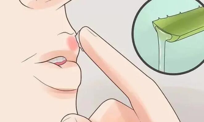 嘴唇起泡動漫.jpg