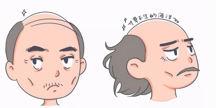 脫發(fā)01.jpg