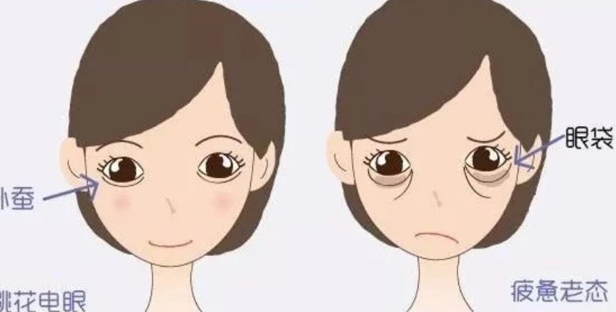 下眼袋浮腫怎么辦？浮腫的原因有哪些？如何緩解呢？