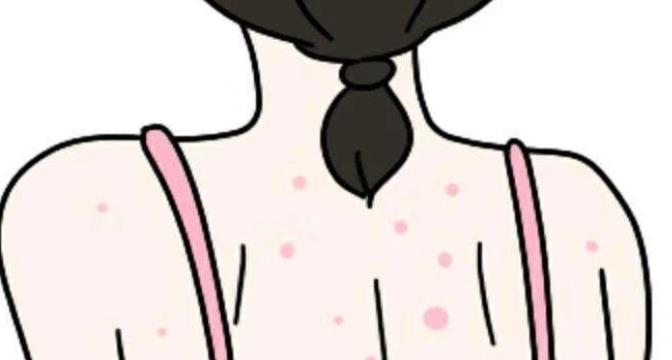 背上長痘痘什么原因?qū)е碌模咳绾稳コ巢慷欢唬?></a>
							</div>
							<div   id=