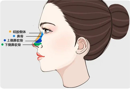 使用膨體隆鼻手術(shù)的優(yōu)點(diǎn)是什么?