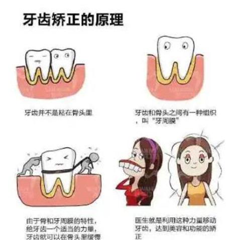 蘭州大學(xué)口腔醫(yī)院牙齒矯正怎么樣？網(wǎng)友感受+價(jià)格表詳情一覽！