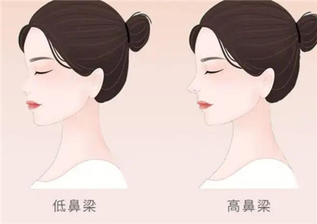 用耳軟骨墊鼻尖有什么好處?