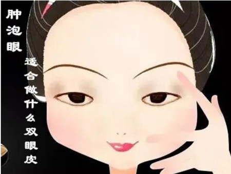 腫眼泡適合做什么樣的雙眼皮