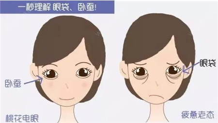 內(nèi)切眼袋手術(shù)會(huì)影響視力嗎?