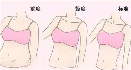 腰部吸脂有沒有風險?