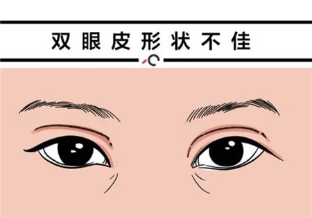 如果埋線雙眼皮后有感染怎么辦?