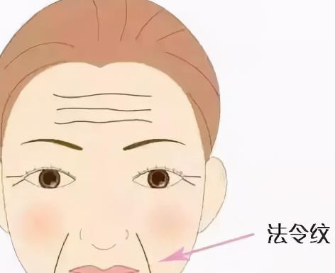 玻尿酸注射除皺效果好嗎?有哪些優(yōu)勢