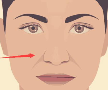 上海南山醫(yī)院小拉皮怎么樣？網(wǎng)友小拉皮真實經(jīng)歷分享~效果值得推薦！