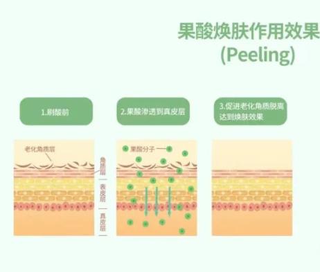 果酸換膚的優(yōu)點借價格影響因素
