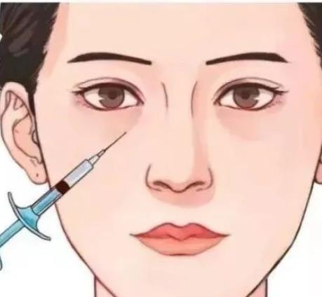 影響玻尿酸豐眼窩的價(jià)格因素有哪些?