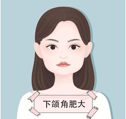 顴骨縮小術(shù)有什么副作用
