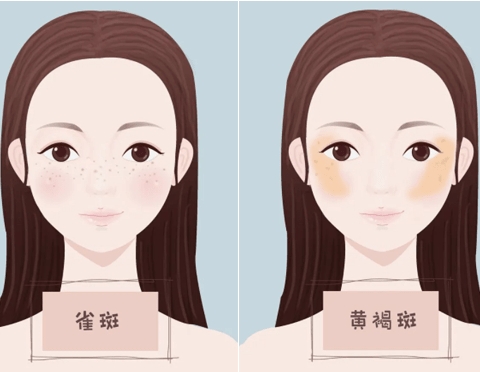 什么是皮秒激光，作用和風(fēng)險(xiǎn)有哪些