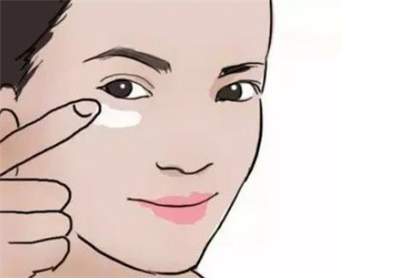 內(nèi)切去眼袋手術(shù)后如何消腫?需要多長(zhǎng)時(shí)間才能恢復(fù)