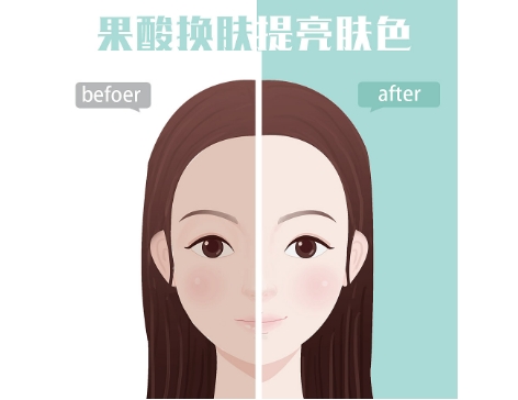 應該多久做一次果酸換膚?