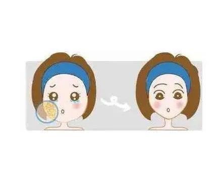 哪些因素決定面部吸脂的安全性