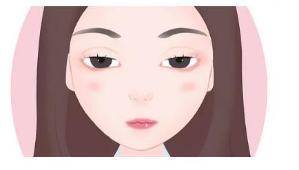 眼瞼外翻手術(shù)方法是怎么樣的?