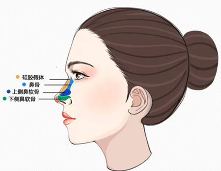 注射隆鼻注意事項是什么？速看注意事項有哪些