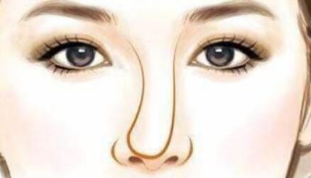 周鴻慶醫(yī)生做鼻子好嗎？醫(yī)生介紹及案例過程分享