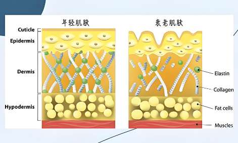 大拉皮和小拉皮的區(qū)別是什么？做拉皮手術(shù)風(fēng)險(xiǎn)高嗎