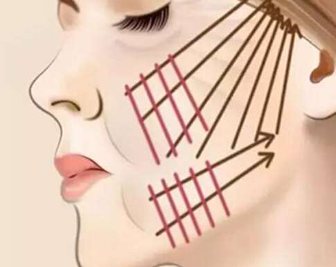 拉皮手術(shù)和線雕哪個(gè)更好？看看區(qū)別有哪些？