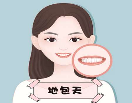 地包天是怎樣形成的？看看項(xiàng)目原理+解決方式了解