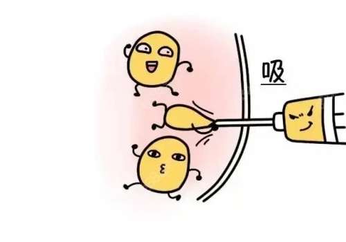 拜拜肉吸脂多久沒(méi)有拉扯感？局麻疼嗎？