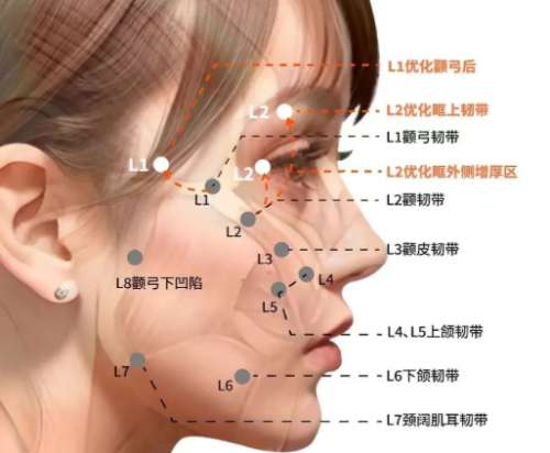 韌帶提升的優(yōu)缺點有哪些？含優(yōu)缺點介紹